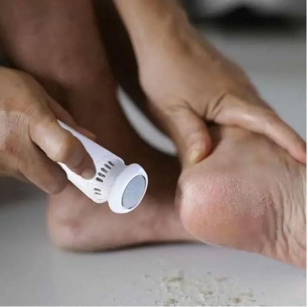 Callus Remover for Feet, Foot File with Removable Roller Head, Compact Pedicure Tool for Dry Hard Skin on Heels and Soles, WG-106, White - image 3