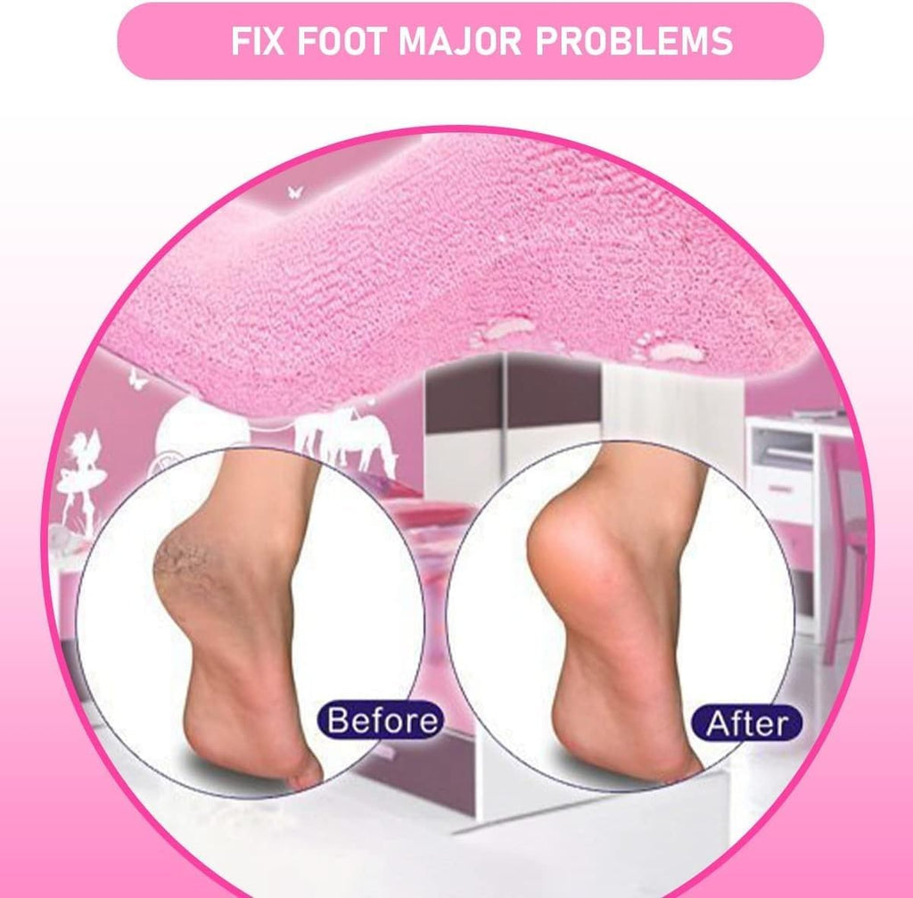 Moisturizing Gel Heel Socks for Dry Cracked Heels with Jojoba Oil Olive Oil Vitamin E One Size Softening Spa Socks Home Foot Care (Pink) - image 4