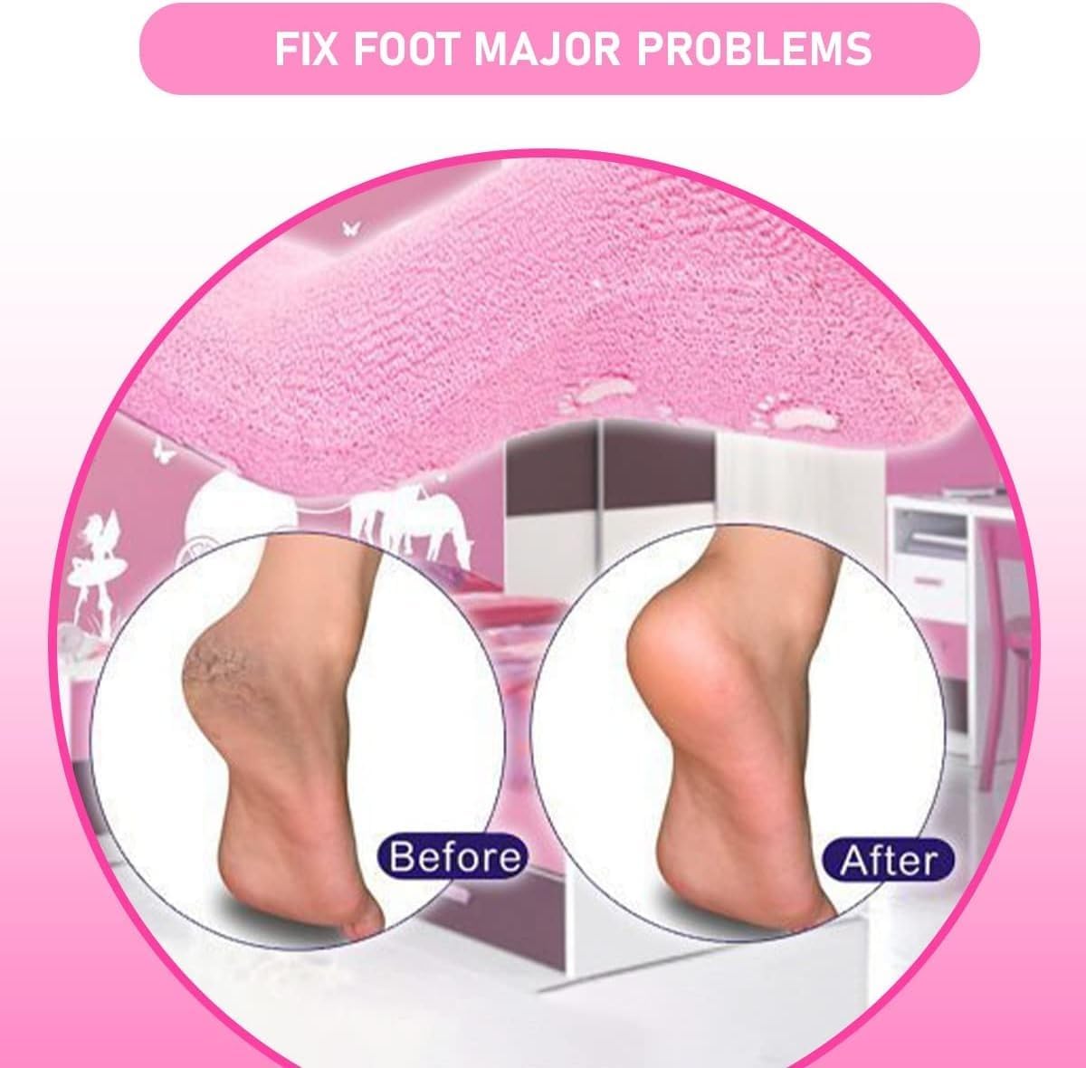 Moisturizing Gel Heel Socks for Dry Cracked Heels with Jojoba Oil Olive Oil Vitamin E One Size Softening Spa Socks Home Foot Care (Pink) - image 4