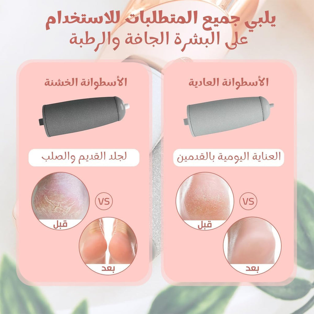 Electric Foot File, Dual-Speed Callus Remover with Easy-Reach Ergonomic Handle for Dry Rough Heels, Toes and Feet, Portable Pedicure Tool, Pink - image 4