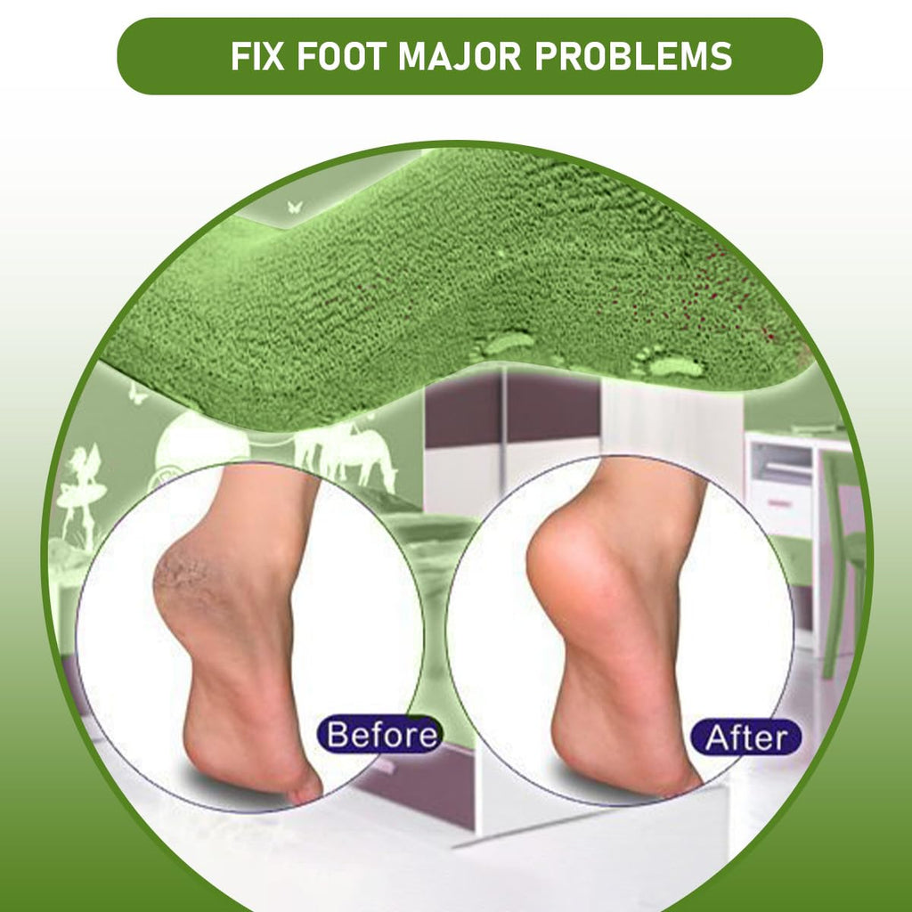 Moisturizing Gel Socks for Dry Cracked Heels, Silicone Spa Heel Socks with Jojoba Oil Olive Oil Vitamin E, Foot Care Pedicure Socks for Women and Men, Reusable Soft Feet Treatment, hanso (Green) - image 4