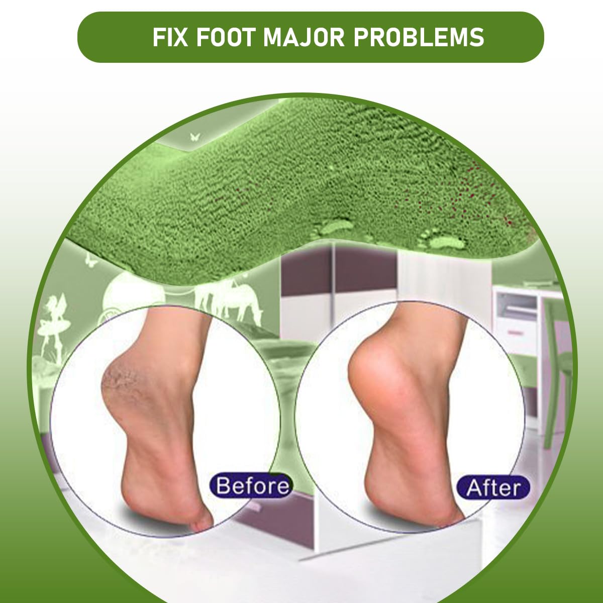 Moisturizing Gel Socks for Dry Cracked Heels, Silicone Spa Heel Socks with Jojoba Oil Olive Oil Vitamin E, Foot Care Pedicure Socks for Women and Men, Reusable Soft Feet Treatment, hanso (Green) - image 4