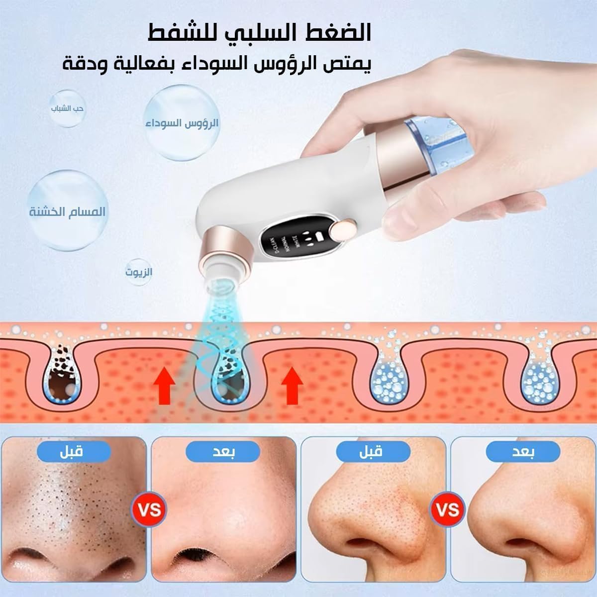 Blackhead Remover Pore Vacuum, Facial Pore Cleaner with Water Cycle System, Electric Skin Care Tool for Deep Cleansing and Visible Buildup Removal - image 3