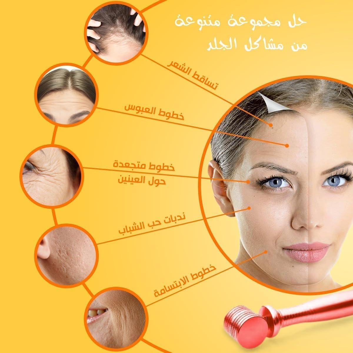 Derma Roller Microneedling Kit, 540 Titanium Micro Needles, Facial Skincare Roller for Face, Beard and Scalp, Home Grooming Tool (Red, 1.00) - image 5