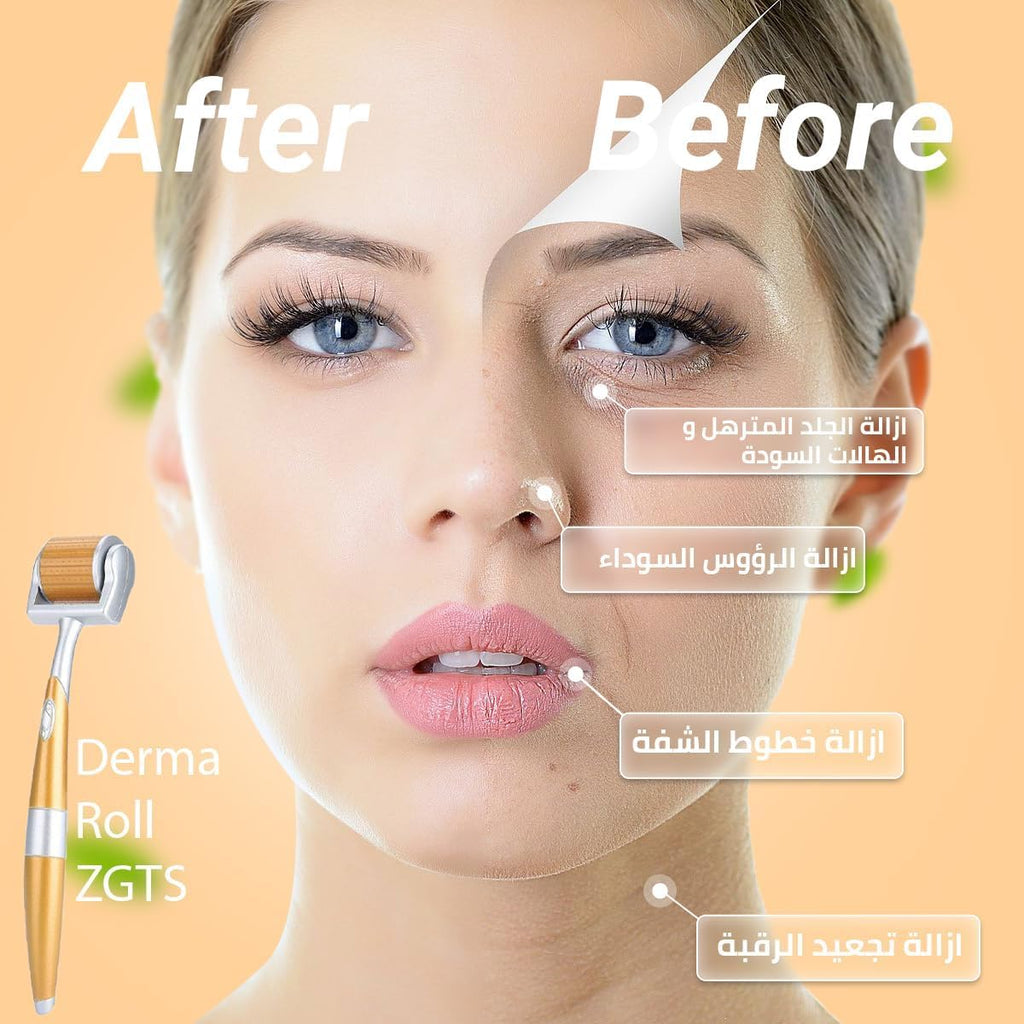 Derma Roller 0.75mm, 540 Titanium Microneedles Skin Care Tool with Ergonomic Handle and Protective Case for Face, Beard and Body - image 4