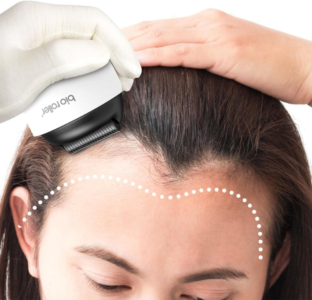 Derma Roller 0.5 mm with 1200 Titanium Microneedles, Easy-Grip Microneedling Roller for Face and Body, Handheld At-Home Skincare Tool - image 6